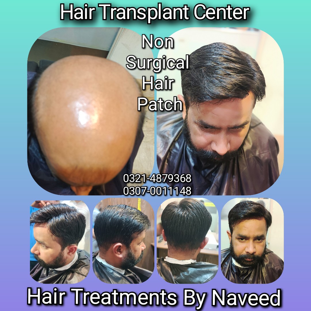 Hair Patch Hair Wig Hair Cap Hair Extension