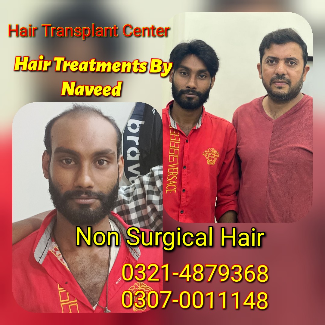 Hair Patch Hair Wig Hair Cap Hair Extension