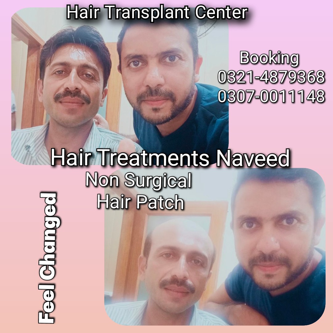 Hair Patch Hair Wig Hair Cap Hair Extension