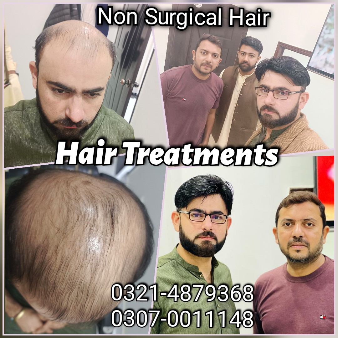 Hair Patch Hair Wig Hair Cap Hair Extension