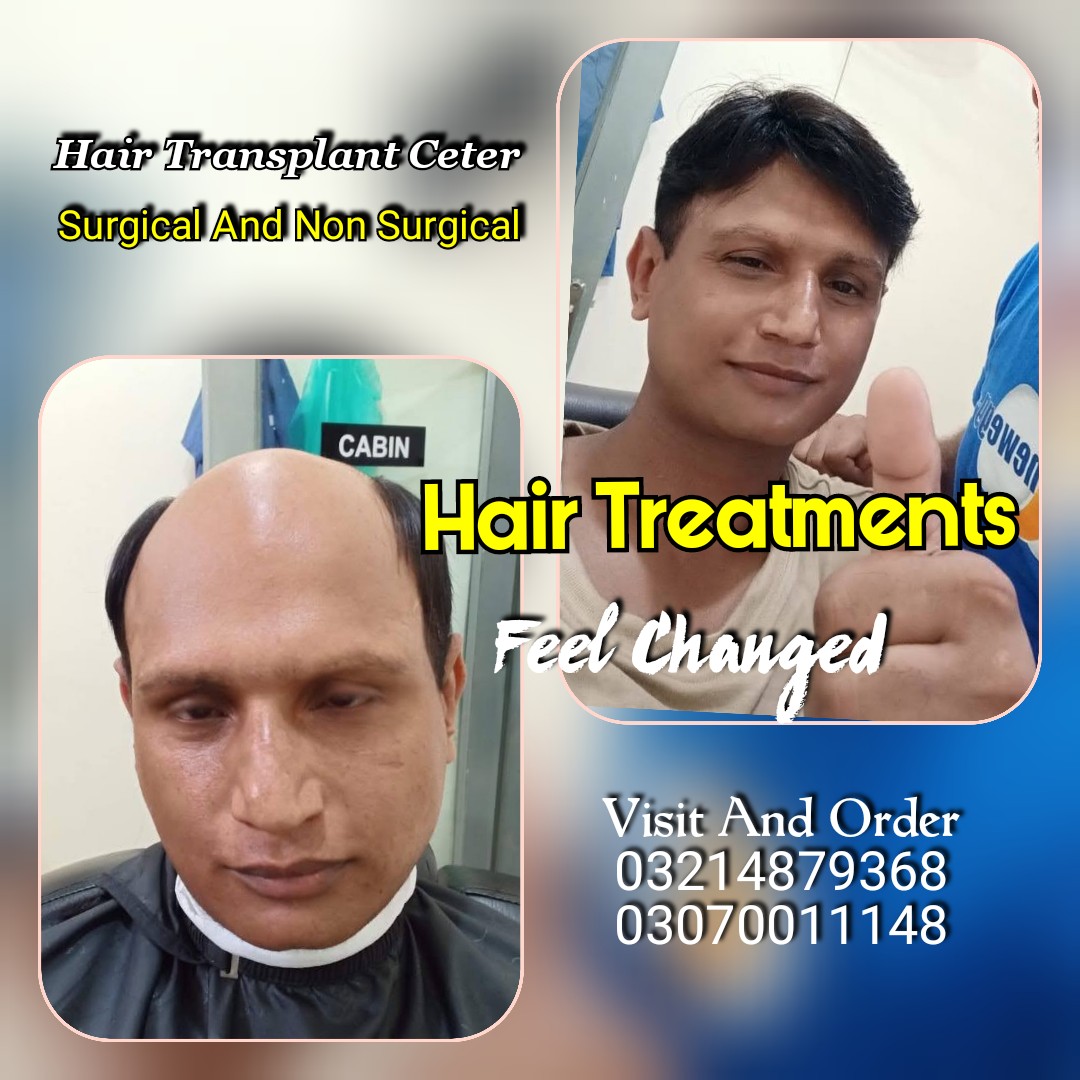 Hair Patch Hair Wig Hair Cap Hair Extension